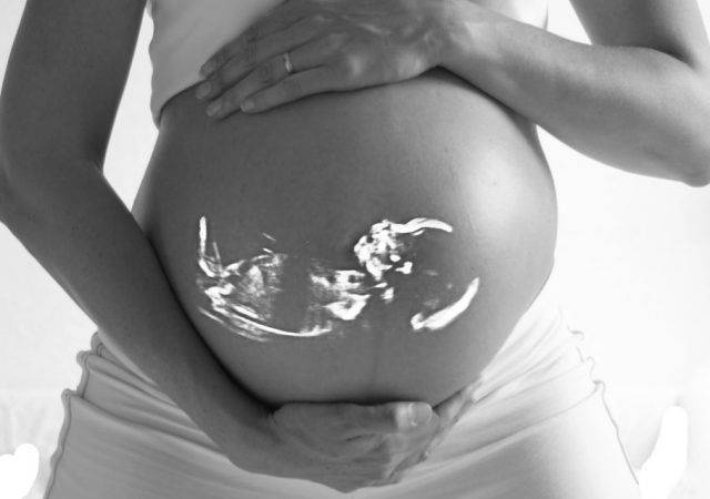 奇跡はめったにない？いえ、実はあなたの目の前に